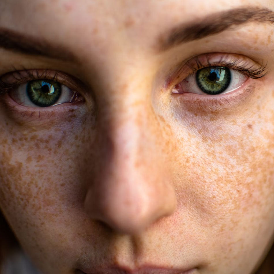 Ojos